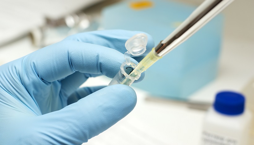 Professor Edna Hardeman from the University of NSW is researching the potential side effects of anti-tropomyosins.